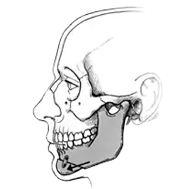 TMJ Problems & Jaw Surgeries